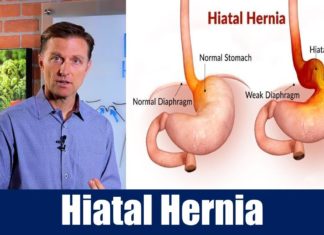 The Hiatal Hernia Quick Fix